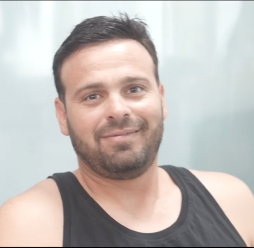 אחרי הטיפול - מראה מלא וטבעי